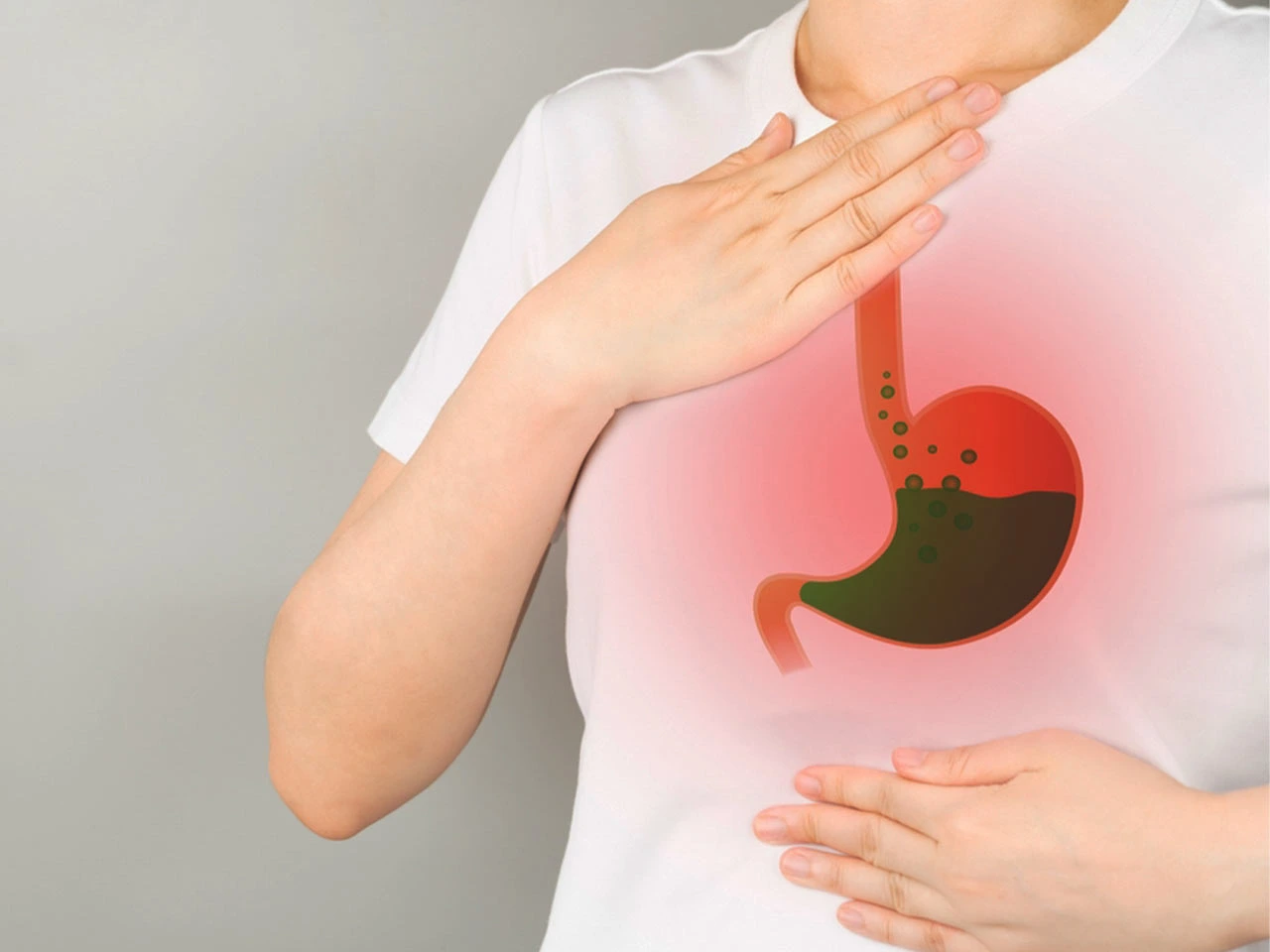 اعراض ارتجاع المرئ بعد عملية التكميم